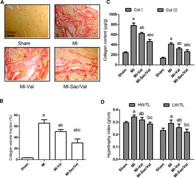 Protective Effects of Sacubitril/Valsartan on Cardiac Fibrosis and Function in Rats With Experimental Myocardial Infarction Involves Inhibition of Collagen Synthesis by Myocardial Fibroblasts Through Downregulating TGF-β1/Smads Pathway